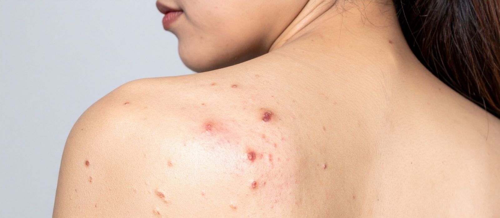Woman examining clear skin in soft natural light