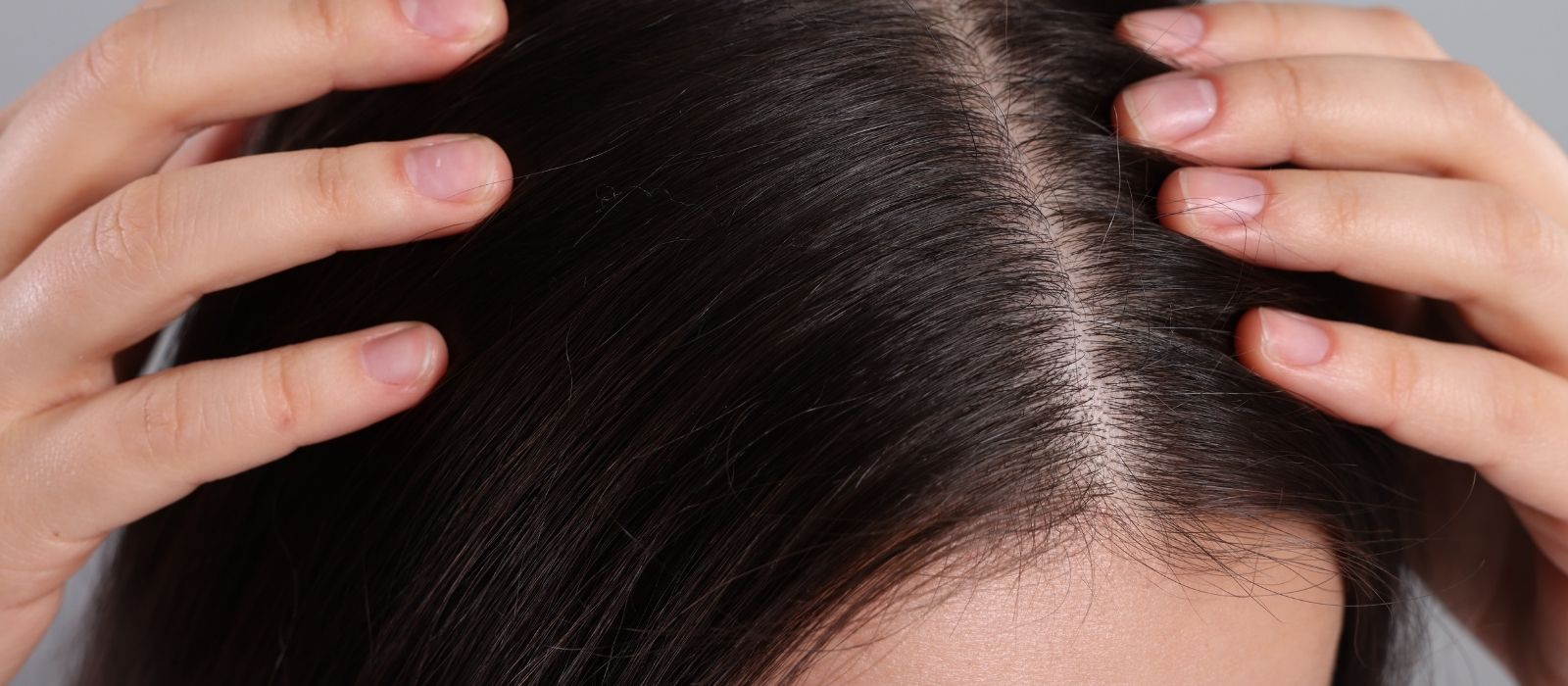 Close up of healthy scalp and hair roots