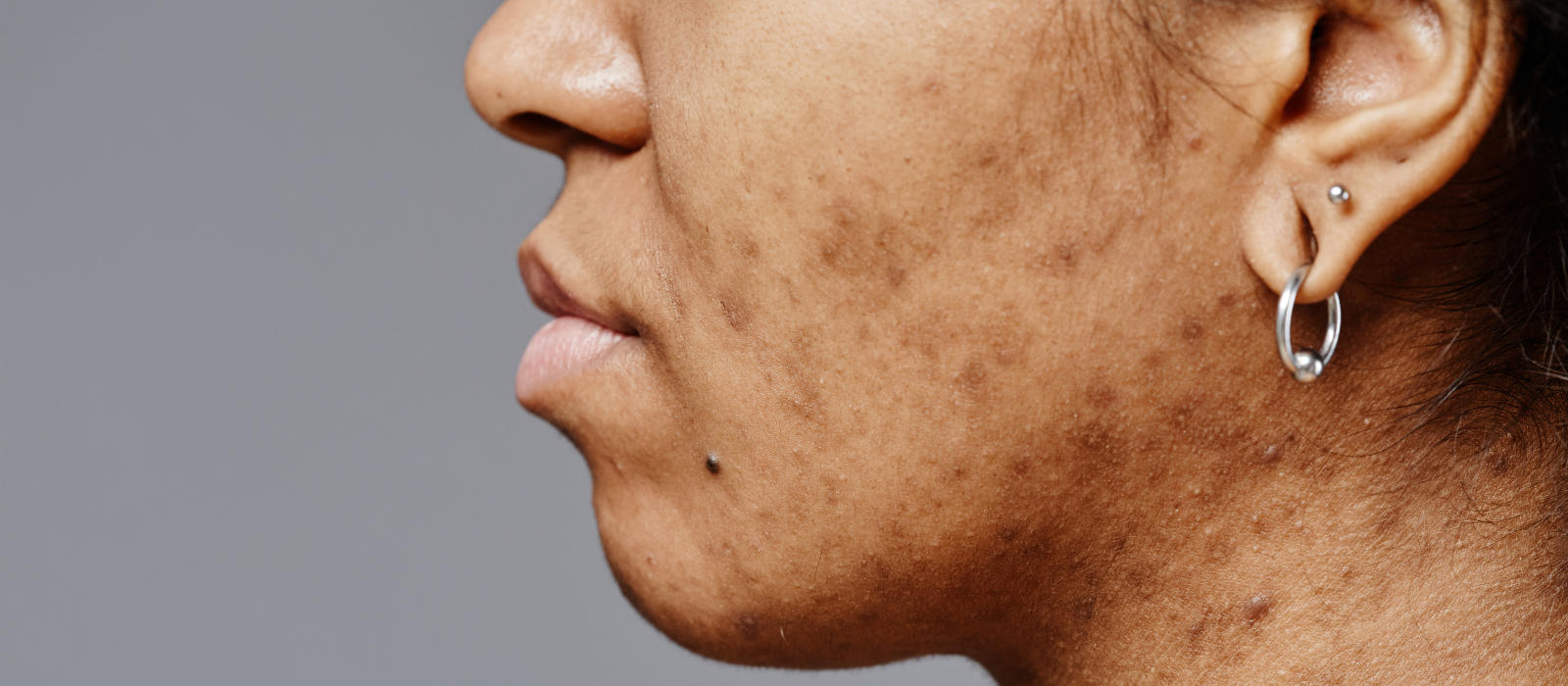 Woman examining clear skin in soft natural light