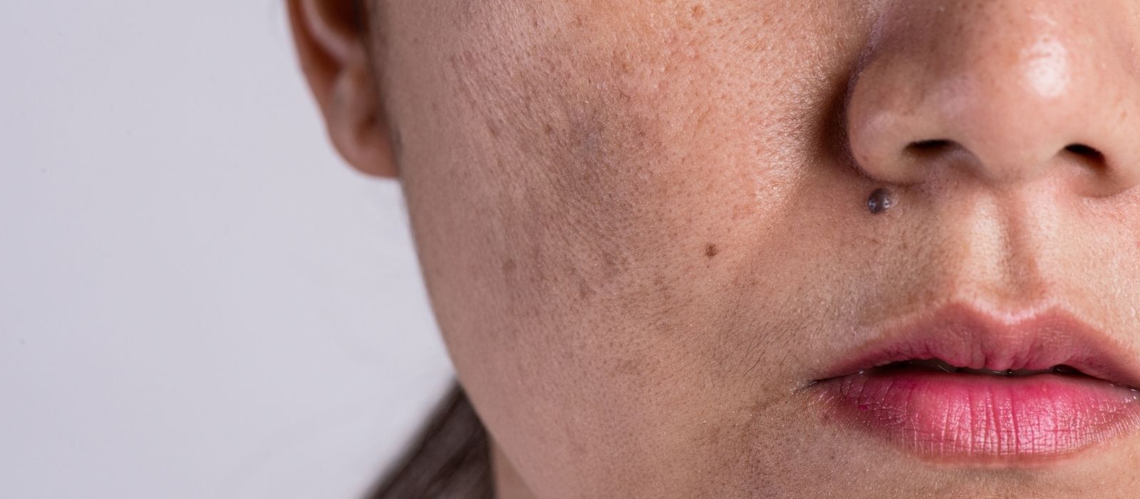 microplastics hormones skin