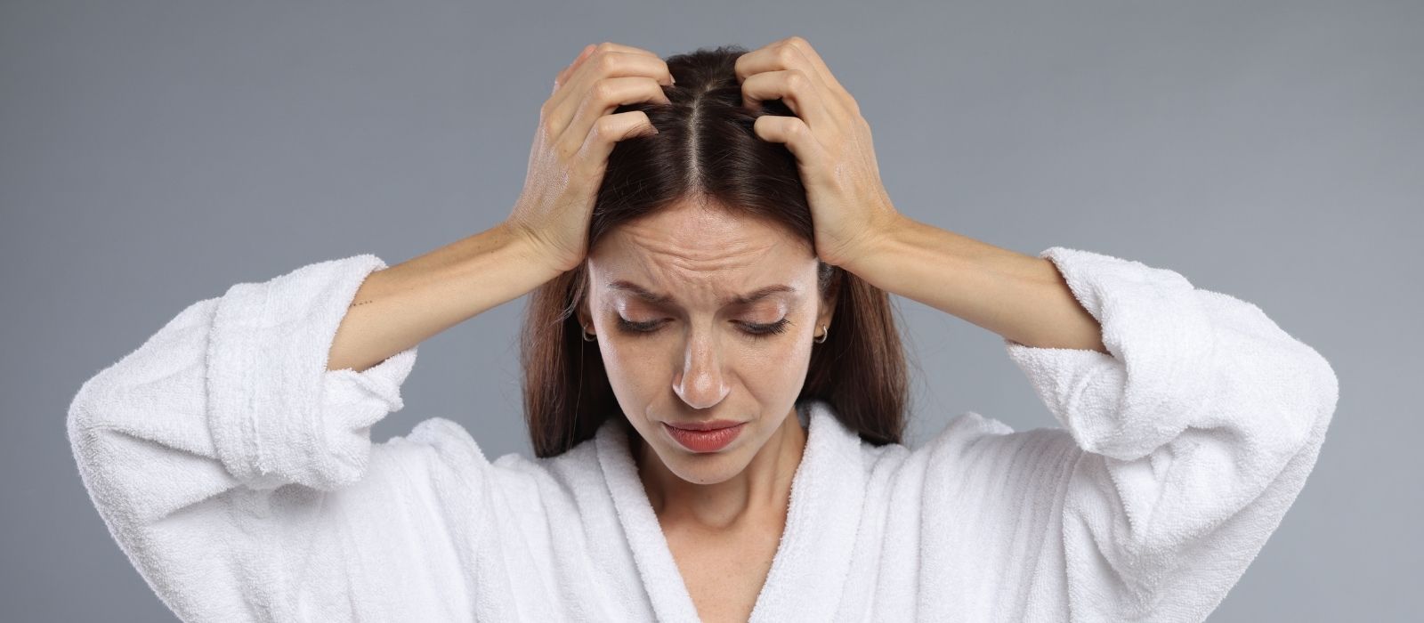 stress hair loss telogen effluvium