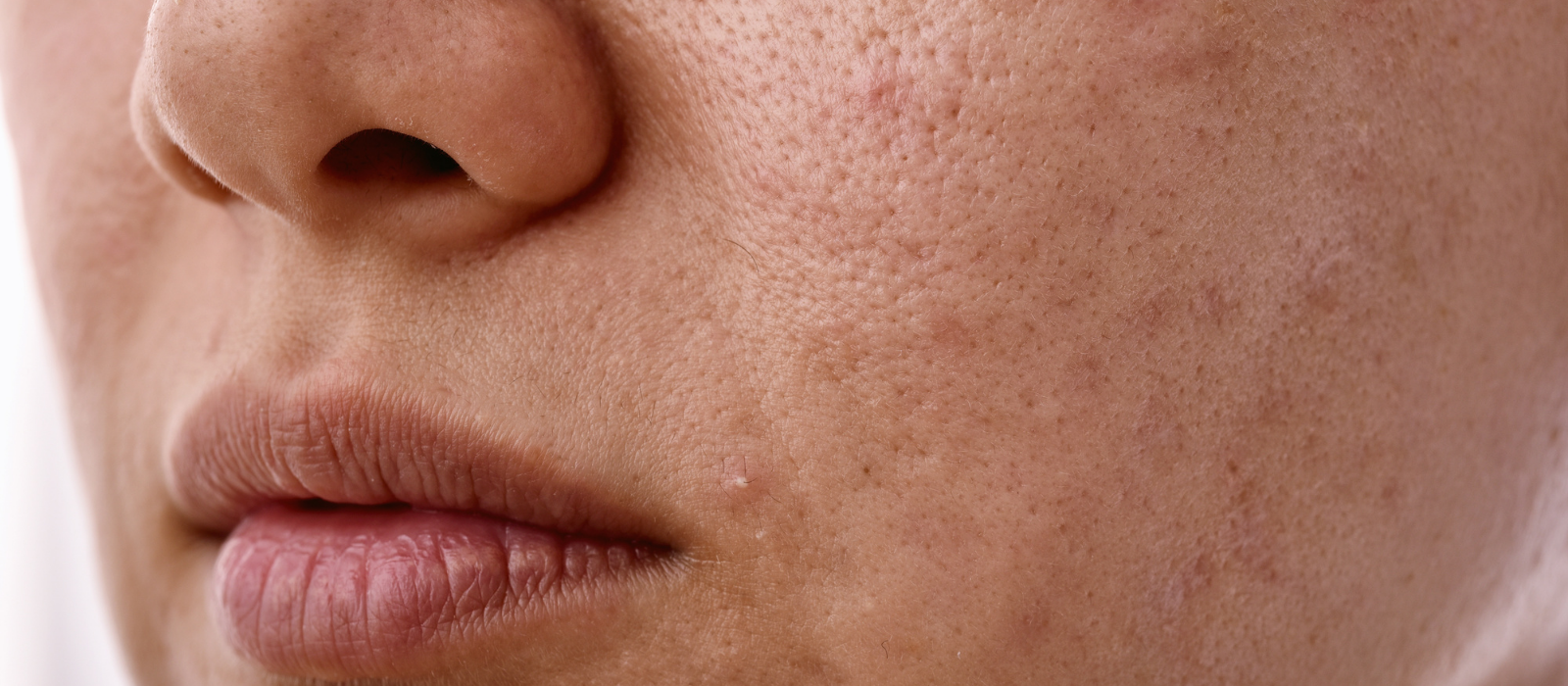 Woman with glowing skin in warm natural light