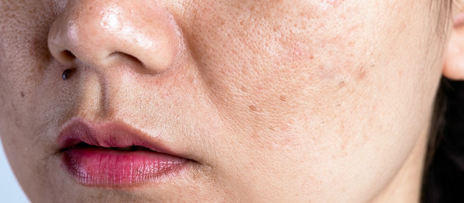 What Chronic Inflammation Does to Skin Over Time