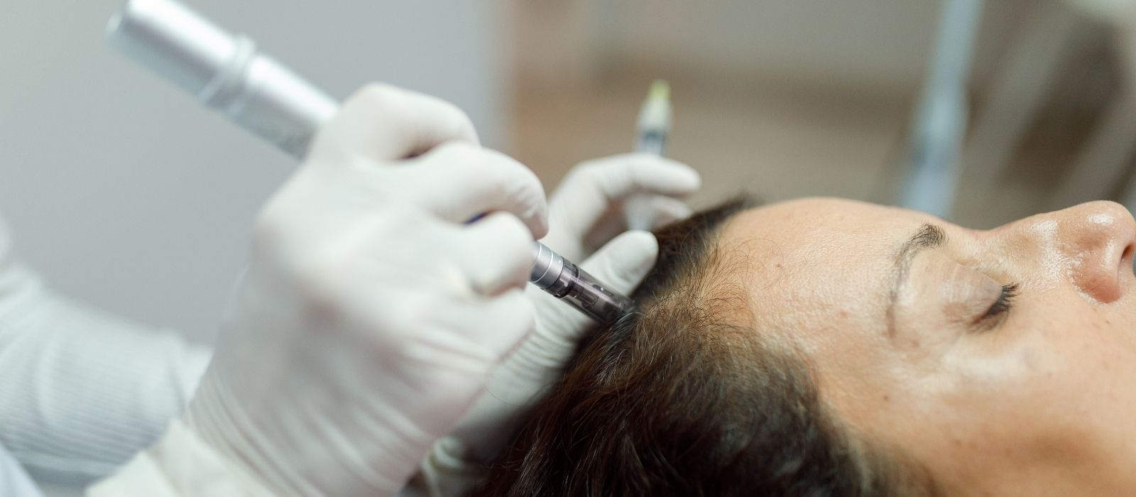 What Exosomes Are Doing to Hair Growth Research — and Whether It's Real